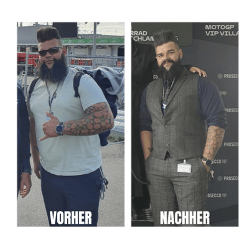 Vorher-Nachher-Vergleich von Rick