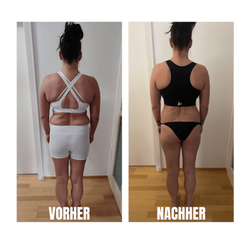 Vorher-Nachher-Vergleich von Melanie