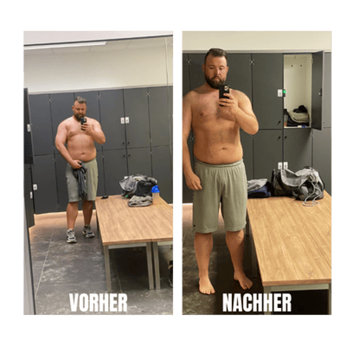 Vorher-Nachher-Vergleich von Stephan